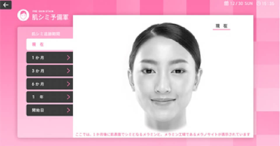 肌分析・シミ検知画面